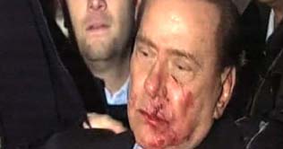 Italian PM Berlusconi attacked at rally