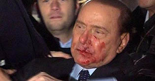 Berlusconi to stay in hospital another night: doctor