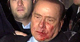 Man arrested outside Silvio Berlusconi's hospital room