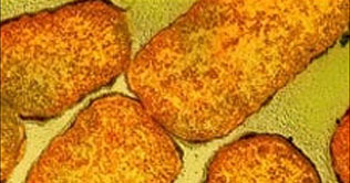 Superbug resistant to all antibiotics discovered in England