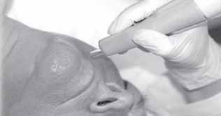 Look young without surgery: Research