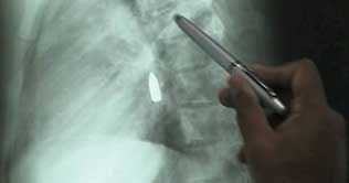 Doctors at PIMS Hosp remove bullet from patients heart