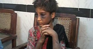 Multan: Lawyer, wife brutally tortured 8-year old maid