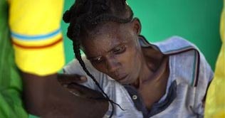 Haiti Cholera death toll hits 643