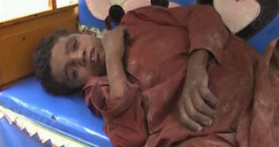 Moro: influential people torture minor, hammer nails inside leg