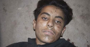 Bomber shifted to Nishtar Hospital in critical condition 