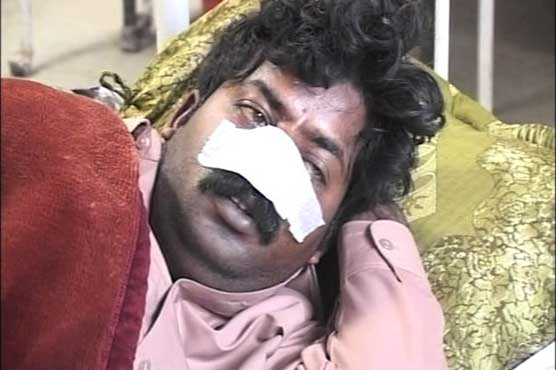 Burewala: Youths nose chopped off