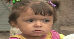 Polio case detected in Peshawar despite campaign