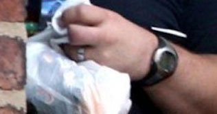 Man blows ups finger to get rid of wart