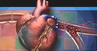 Two-thirds of deaths are caused by non communicable diseases