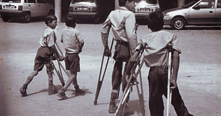 Sukhekhi: MNA bears polio victims treatment expenditures