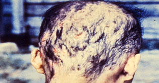 Radioactive leak in Japan could become worse than Chernobyl