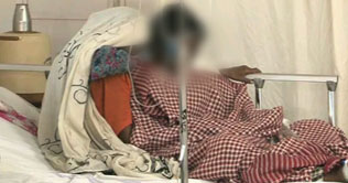 Faisalabad: Police still not registering case of burnt girl