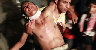 Troops kill 20 protesters in Yemen