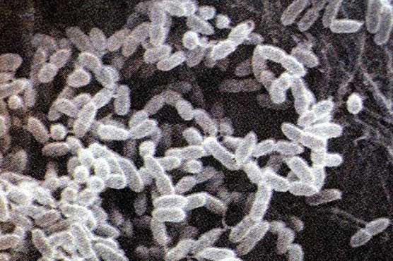 Breakthrough against deadly melioidosis scourge: Report  