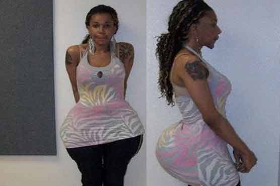 More victims reported in fix-a-flat cosmestic surgery