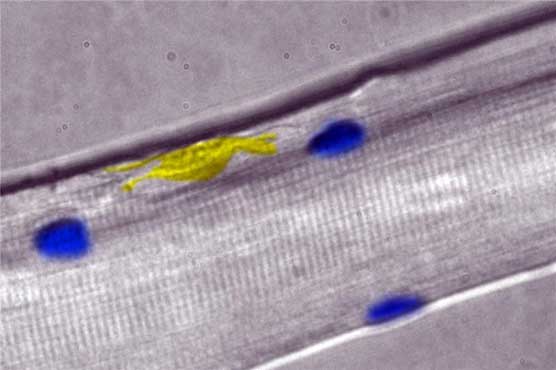 Discovery of a New Muscle Repair Gene