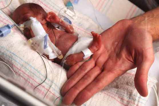 Autism more likely in premature babies