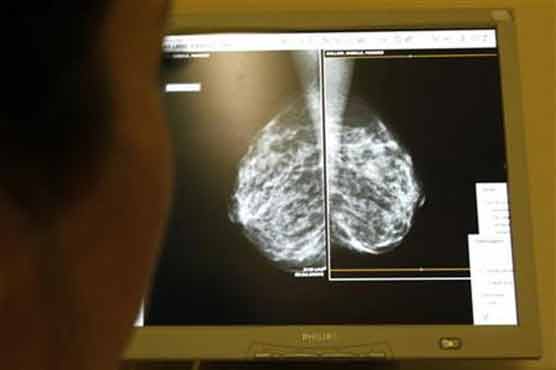 Mammograms not save as many lives as think