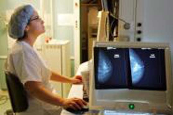 Breast cancer screening review launched