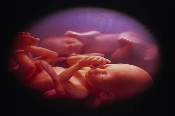 Babies develop facial expressions in womb