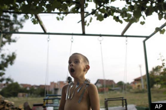  Serb cousins are real-life magnets 