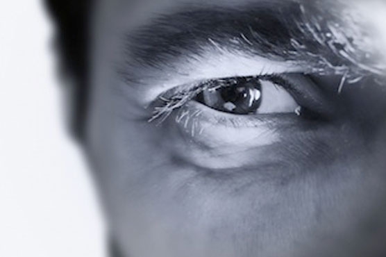 Man bites off chunk of foe's eyebrow during fight