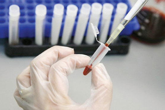 Scientists find way to disarm AIDS virus