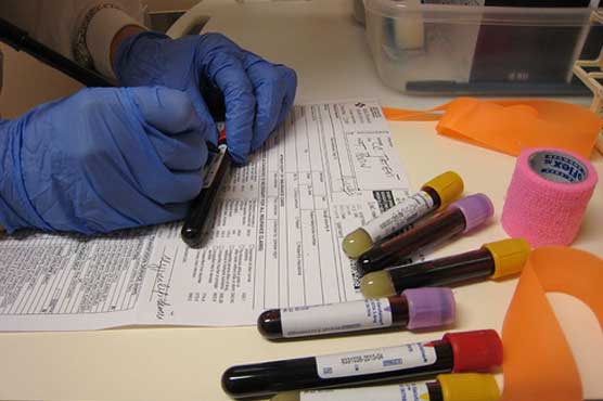 New blood test to diagnose heart attacks