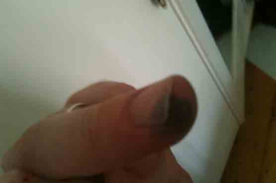 Boy finds 30-year-old human fingers in jar