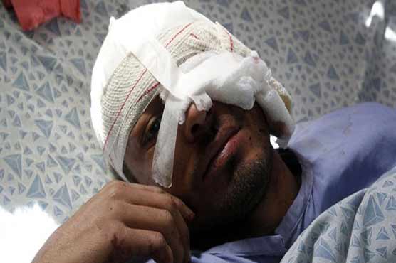 Afghans chop off ears of roadside bomb suspect