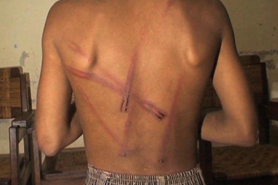 Gujranwala: Factory owner tortures minor servant