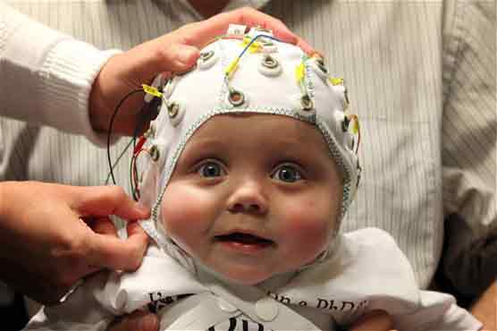 Baby sensor cap test to learn how autism develops 