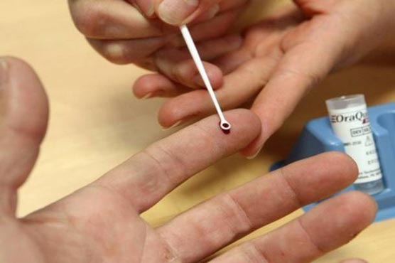  Hepatitis G may trigger liver cancer