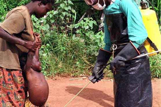 Deadly ebola outbreak in Ugandan capital