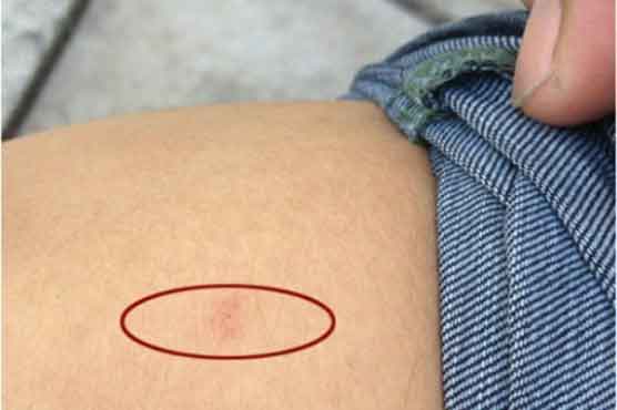 Chinese police launch probe into HIV-infected syringe use