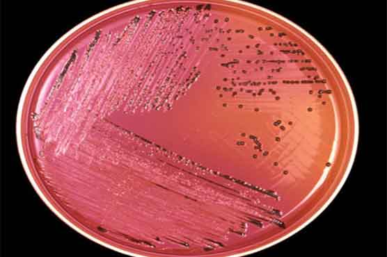  New tests could hamper food outbreak detection