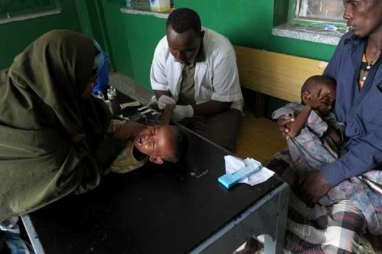 Measles cases rise after decade of decline