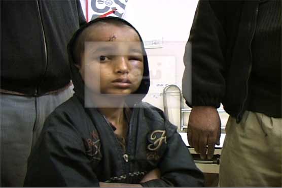 Lahore: Family severely tortures 10-year-old servant 