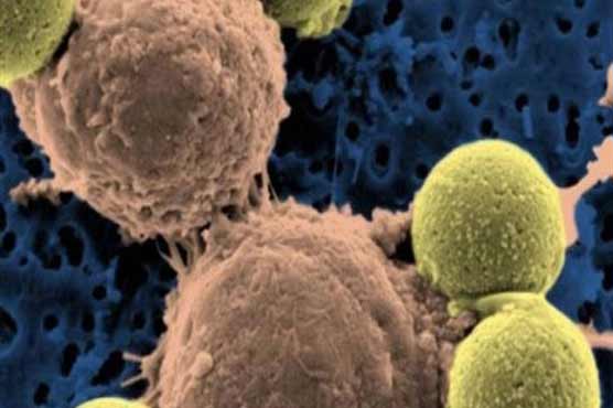 Lifestyle changes can help prevent cancers: WHO