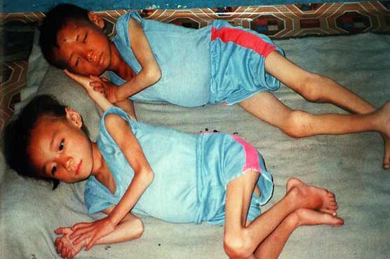 Couple held for starving kids to death