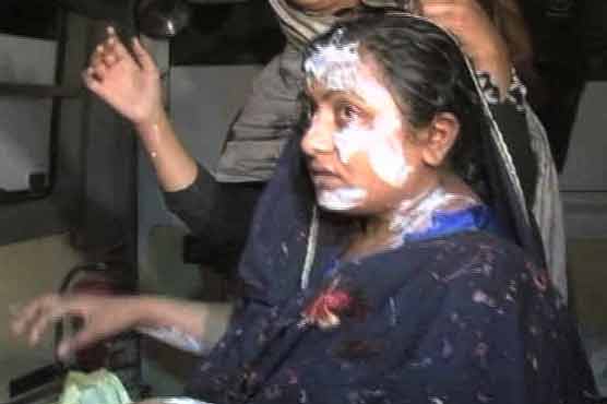 Faisalabad: Man held for throwing acid on women 
