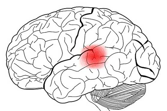 Scientists shift on brain speech centre: study