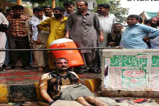 Karachi: Man saved after self-immolation bid