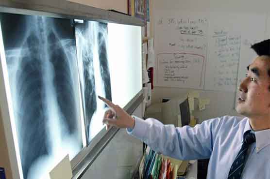 Good news for TB patients