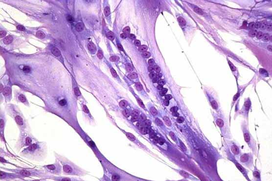 Stem cells stay alive for 17-day in dead bodies: research