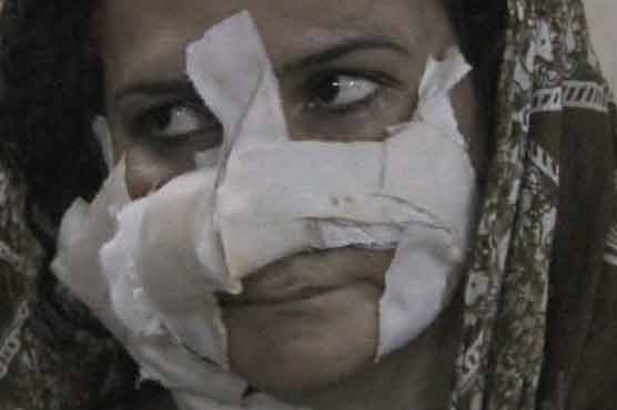 Hala: Womans nose chopped off