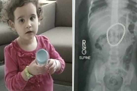 Toddler Swallows 37 Magnets