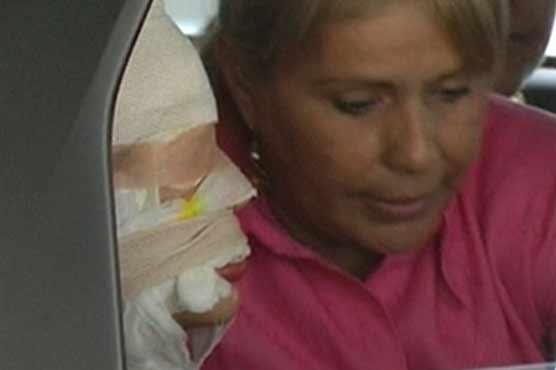Acid attacks on women grow in Colombia
