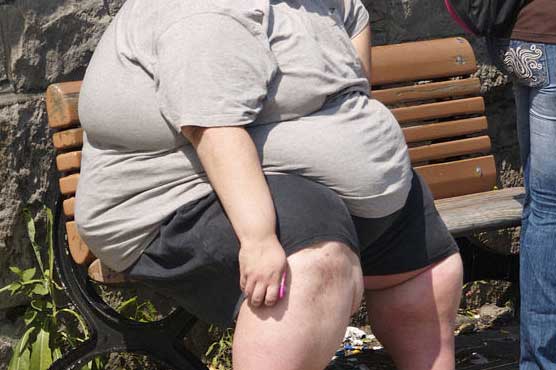 Obese people have joint pain, heart conditions